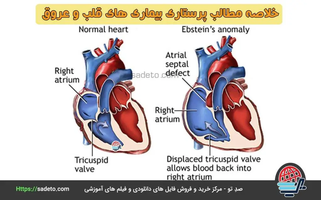 خلاصه مطالب پرستاری بیماری های قلب و عروق
