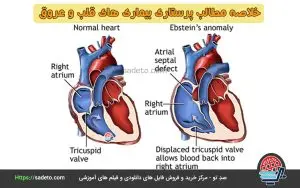 خلاصه مطالب پرستاری بیماری های قلب و عروق